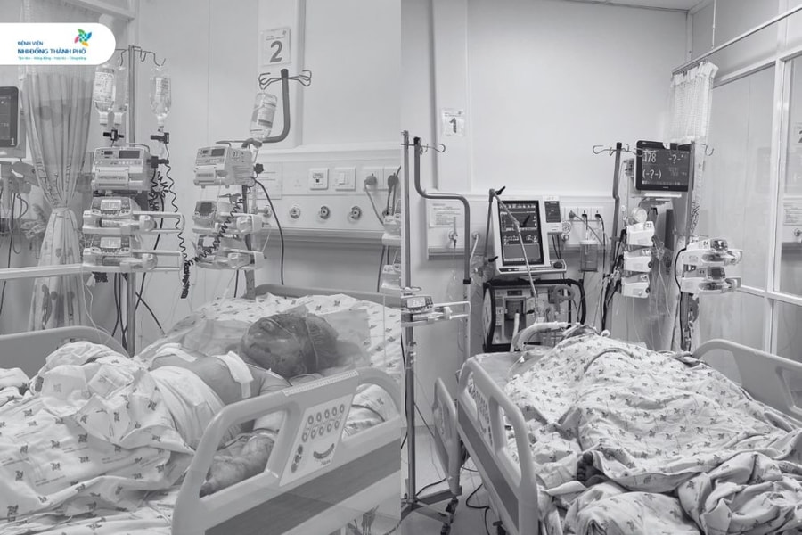 Hai chị em nhập viện trong tình trạng nguy kịch vì bị người cha phóng hỏa