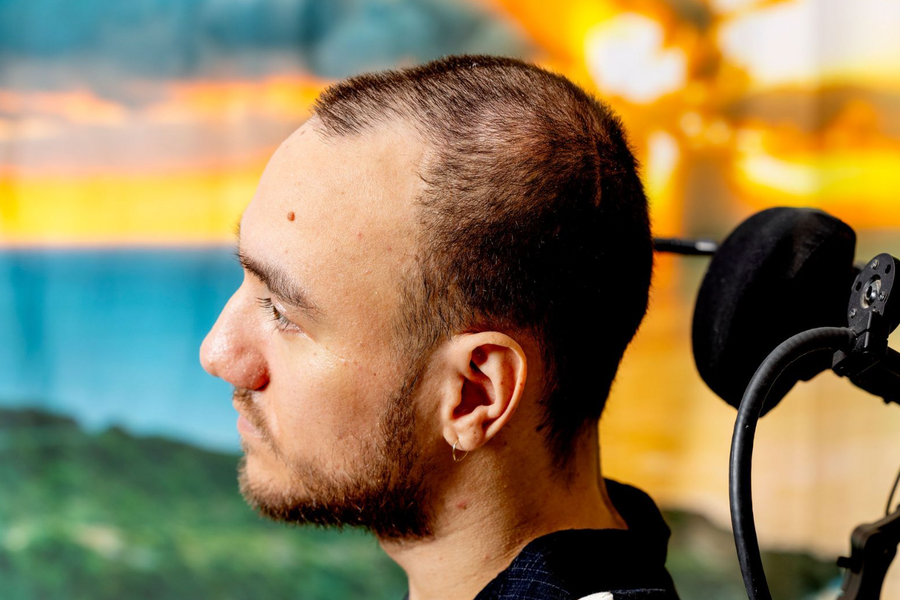 18 tháng sau khi cấy chip não Neuralink, “người tham gia số 1” hiện thế nào?