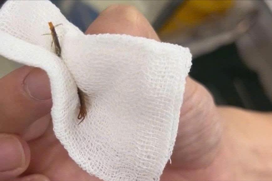 Hy hữu: Con rết dài 5cm chui vào tai người đàn ông đang ngủ