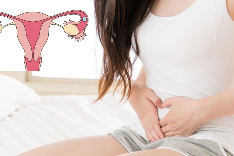 Sản phụ nguy kịch, tràn ổ bụng 1,5 lít máu do vỡ khối chửa ở vòi tử cung