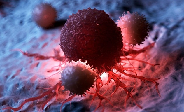 10 dấu hiệu bệnh ung thư đang âm thầm tiến triển trong cơ thể