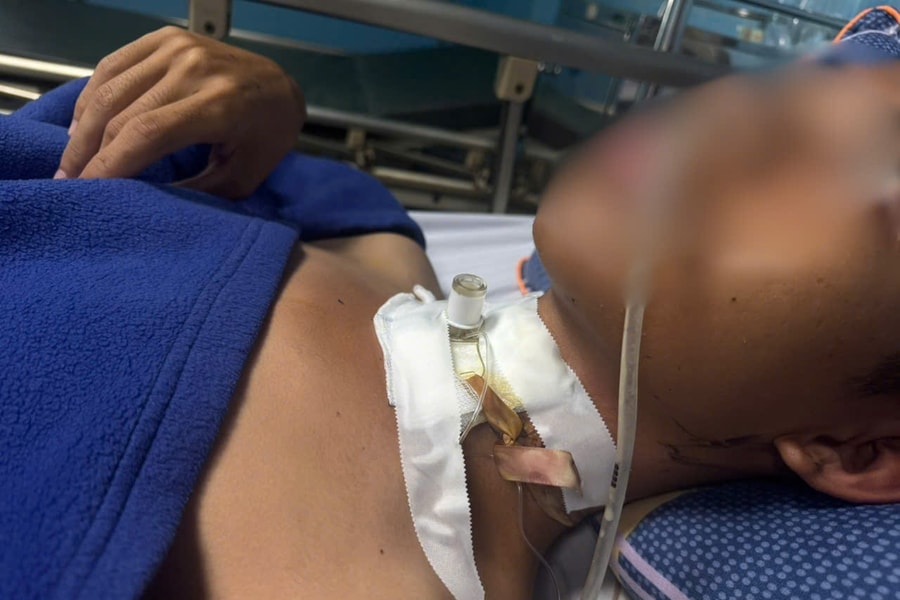 Quảng Trị: Cấp cứu bệnh nhân bị đứt khí quản do vướng dây điện khi đi đường