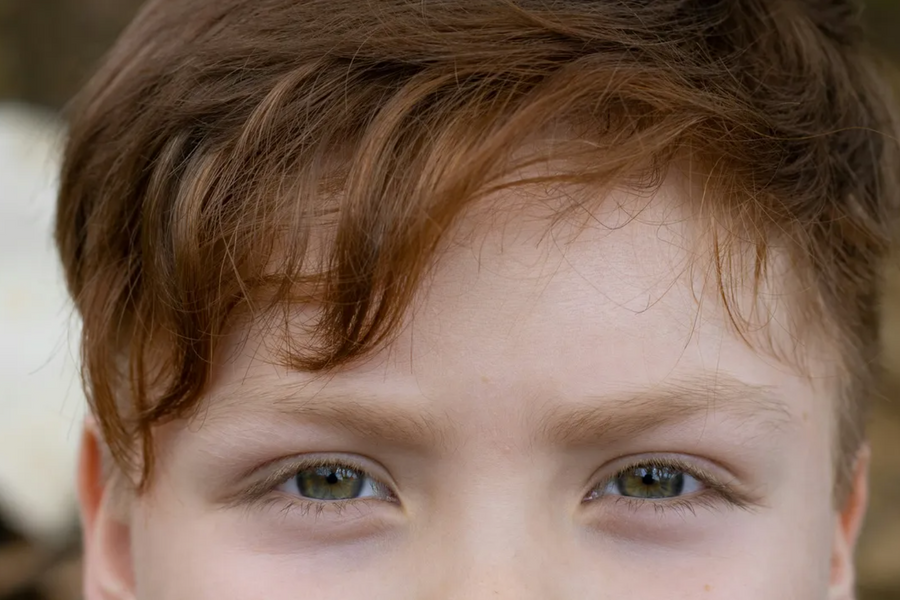 Ô nhiễm làm tăng tỷ lệ cận thị ở trẻ em