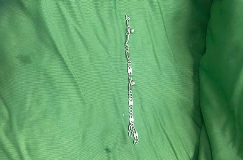 Cấp cứu kịp thời bé gái 5 tuổi nuốt vòng tay bạc dài 7cm