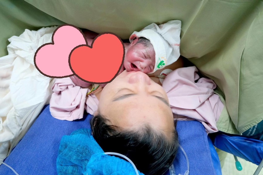 Hiếm gặp: Bé gái mắc hội chứng truyền máu song thai - một thai không tim