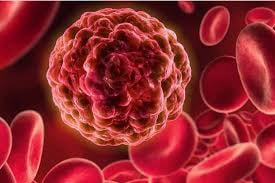 Bệnh nhân đột quỵ đầu tiên được cấp cứu thành công ngay tại Côn Đảo