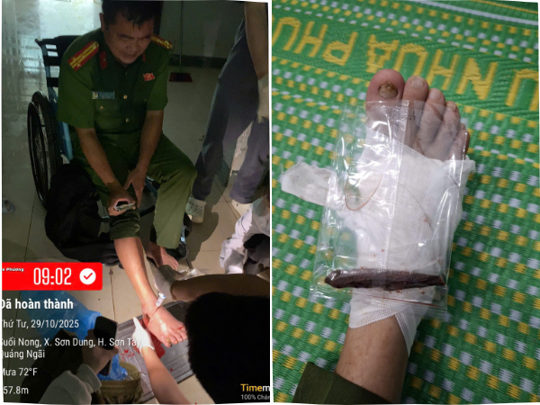 Trưởng công an xã bị thương vẫn bám hiện trường giúp dân sơ tán trong lũ