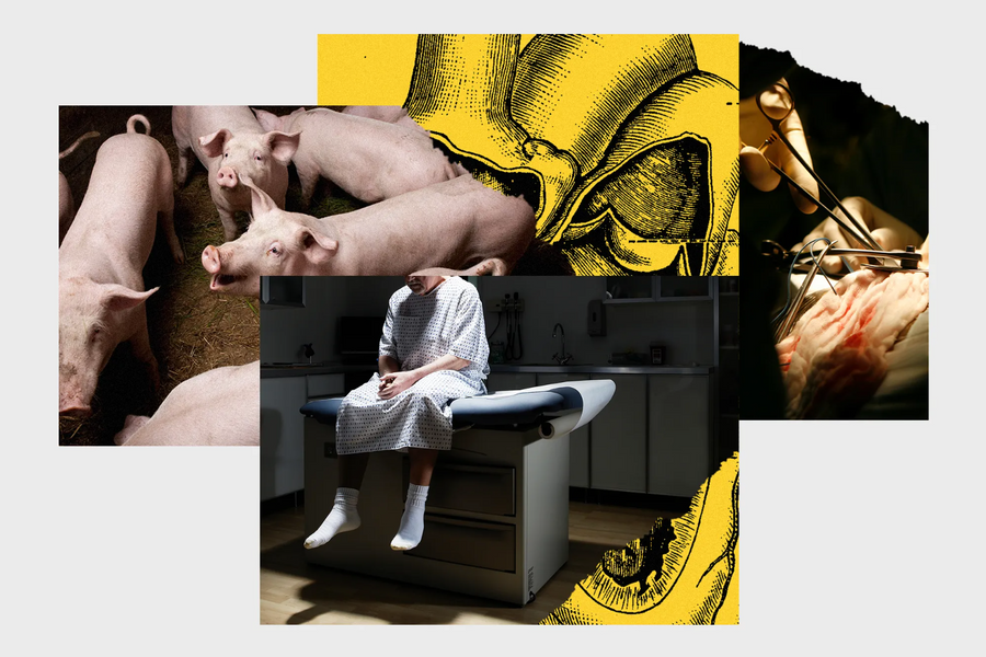 Nội tạng lợn có thể sớm cứu sống con người như thế nào?