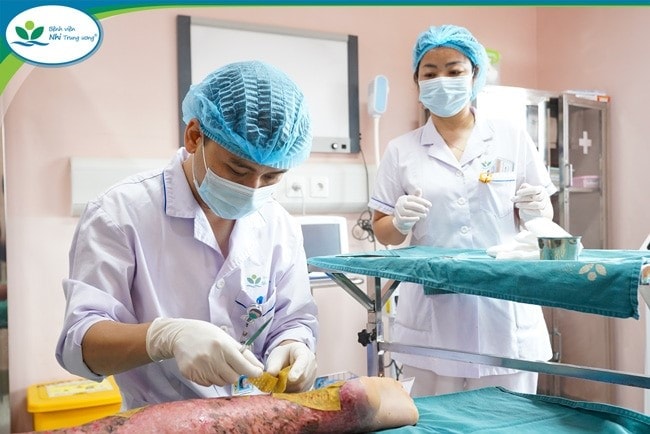 Bé trai 6 tuổi bỏng nặng do nghịch cồn trong phòng tắm