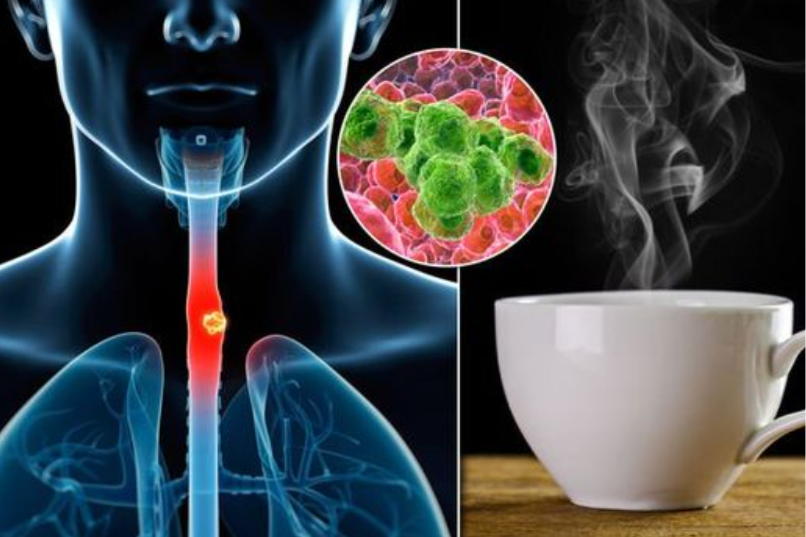 Cảnh báo mới về uống đồ nóng: Nguy cơ gây ung thư!