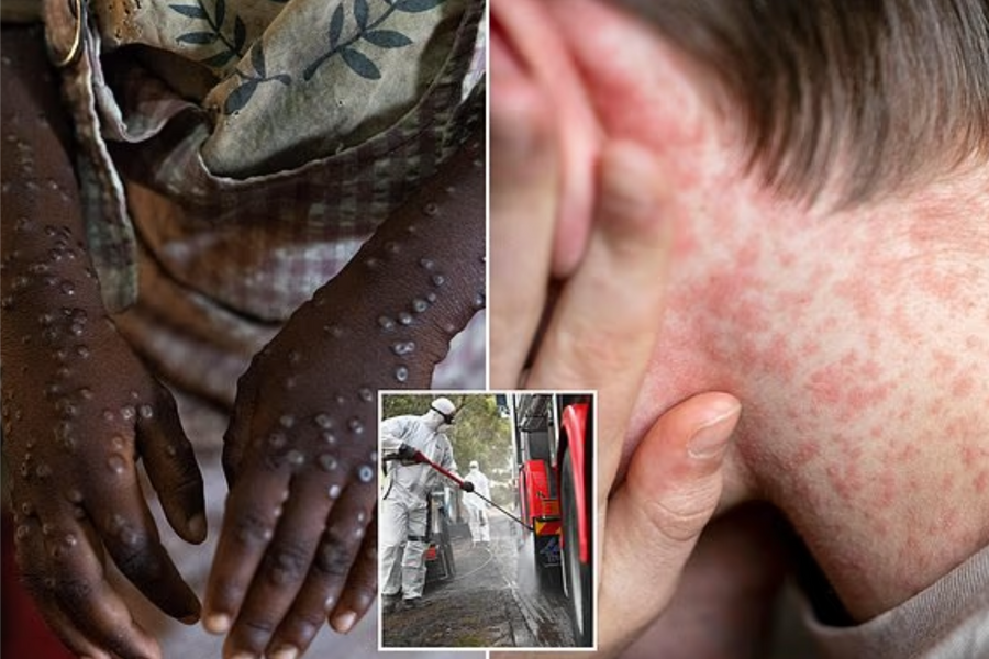 Ở ngưỡng cửa đại dịch? Những virus khiến giới khoa học lo ngại trong năm 2026