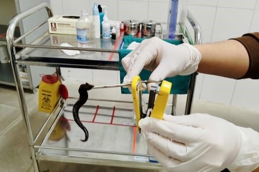 Đỉa dài 10 cm ký sinh trong mũi người bệnh