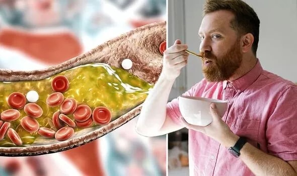 Ba cách giúp kiểm soát cholesterol từ chế độ ăn và lối sống