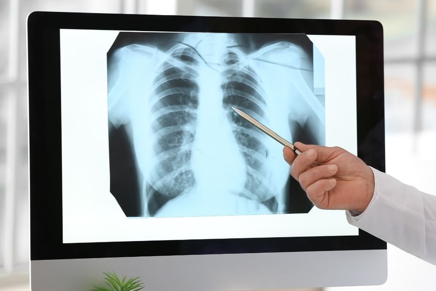 Bộ Y tế đề nghị thanh toán bảo hiểm y tế kỹ thuật điện quang không phụ thuộc vào thời gian chụp chiếu