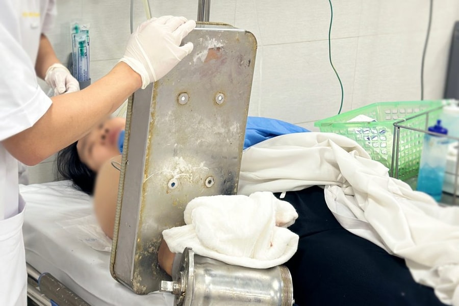 Hy hữu: Phẫu thuật cắt cụt chi do kẹt bàn tay trong máy xay thịt