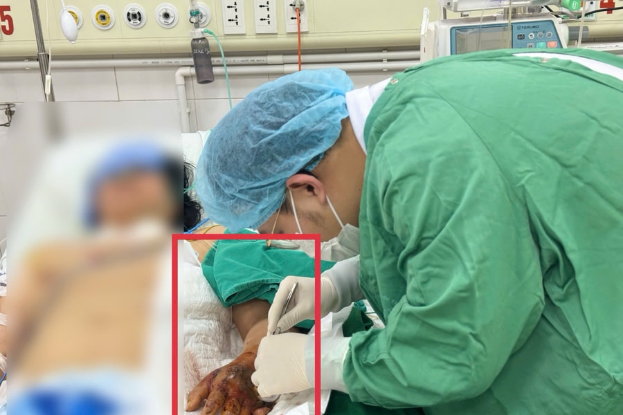 Sốc nhiễm khuẩn nặng sau khi tiêm thuốc ở phòng khám tư