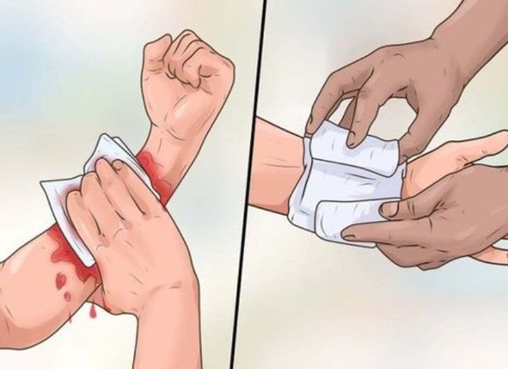 Đắp lá chữa vết thương, bệnh nhân tử vong vì uốn ván