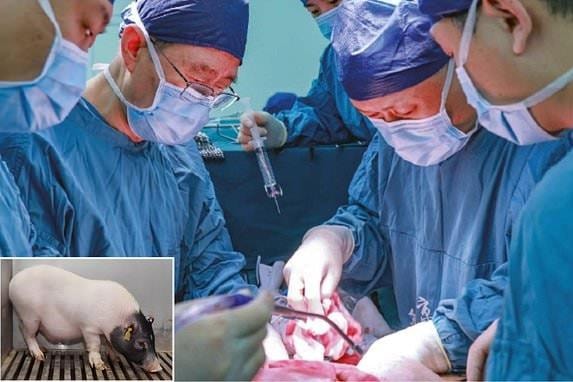Bước đột phá y học: Lần đầu ghép đồng thời gan và thận lợn cho người