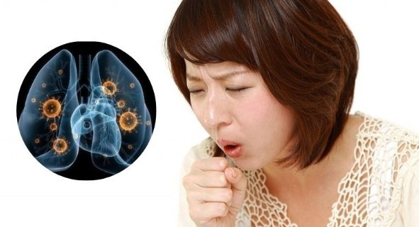 Bệnh lao âm thầm gia tăng, bác sĩ khuyến cáo người trẻ không nên chủ quan