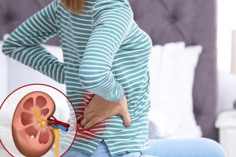 Sỏi thận âm thầm gây suy thận như thế nào?