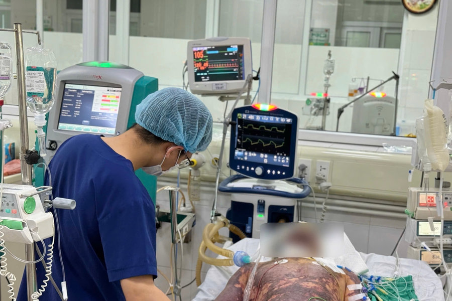 4 ca nhiễm liên cầu lợn trong hai tuần: Cảnh giác nguy cơ từ thực phẩm không an toàn